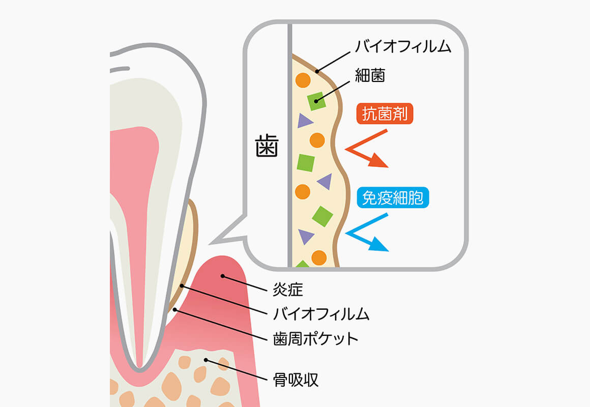 なによりもバイオフィルムの除去が大切です！